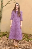 Filename=Keira2BKnightley2BChanel2BPhotocall2BParis2BFashion2BZkeLCnlt-wul.jpg
Filesize=122KiB
Dimensions=400x600
Date added=Mar 06, 2018 Keira2BKnightley2BChanel2BPhotocall2BParis2BFashion2BZkeLCnlt-wul.jpg
